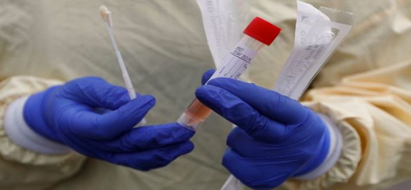 Coronavirus, aggiornamento odierno: un nuovo caso nella Bat e 2 decessi