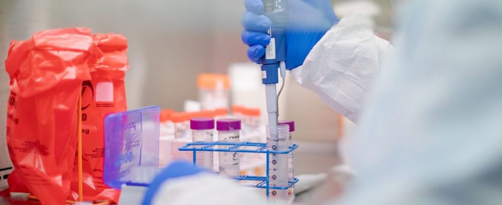 Aggiornamento Coronavirus: 2 nuovi casi nella Bat e 1 decesso