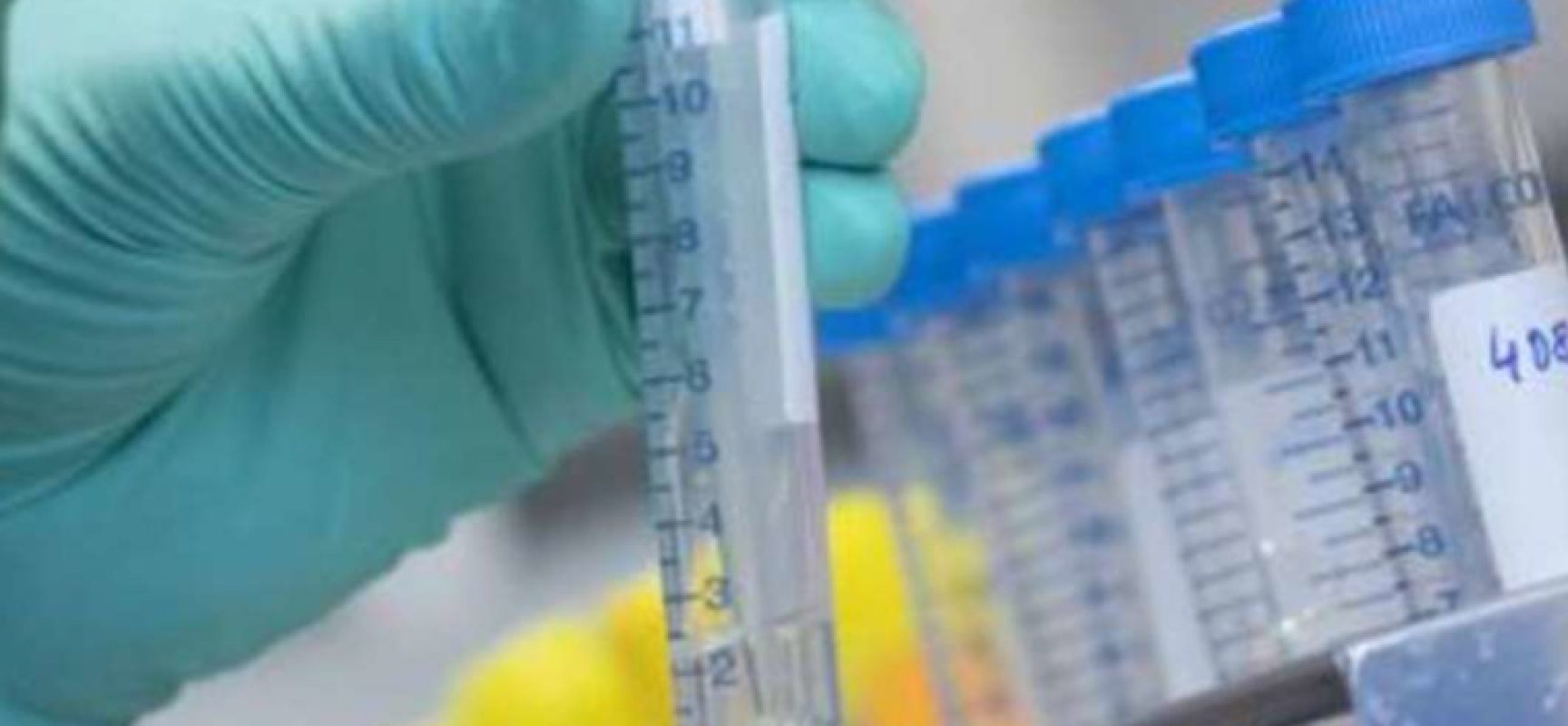 Coronavirus, aggiornamento odierno: 39 nuovi casi e 2 decessi nella Bat