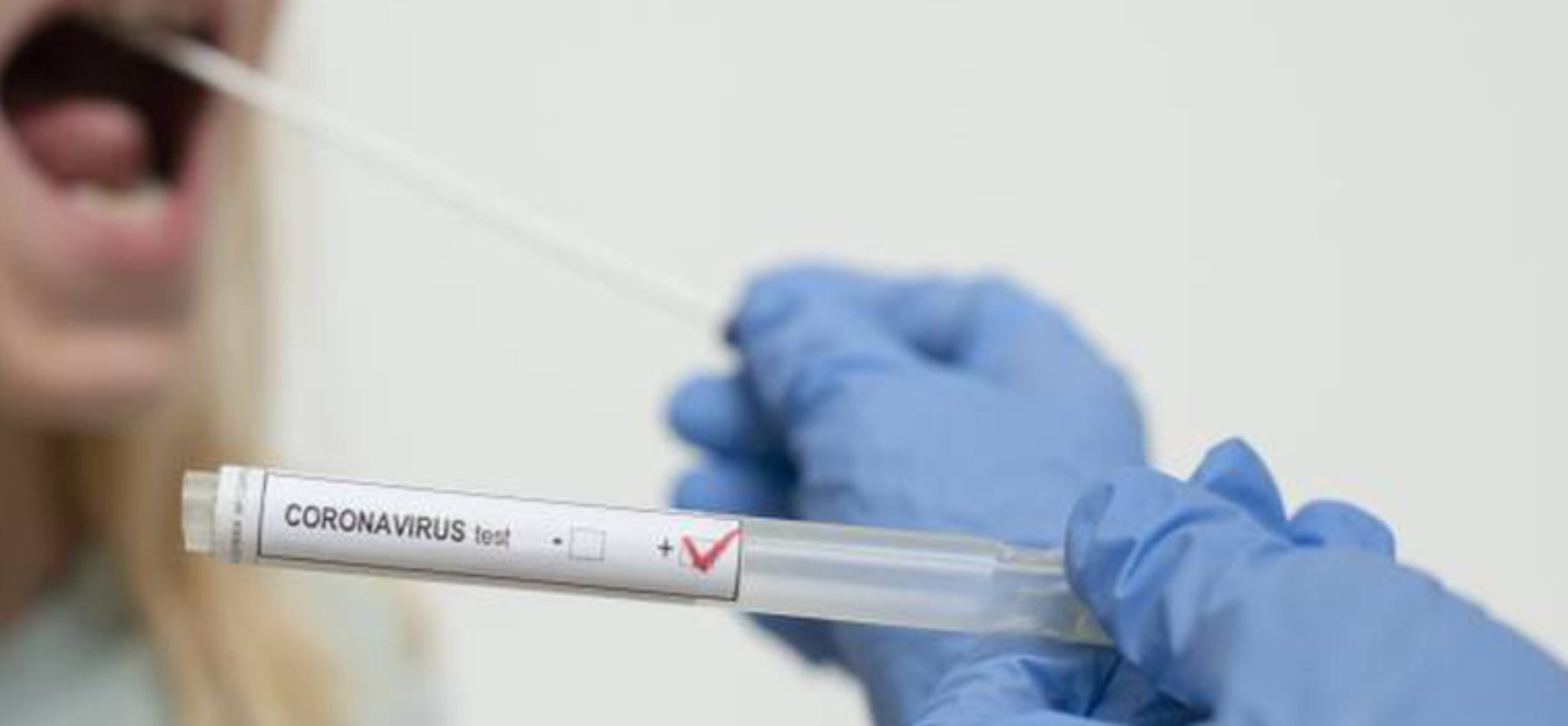 Coronavirus: 173 nuovi casi in Puglia, oltre 200 i ricoveri nei reparti ordinari