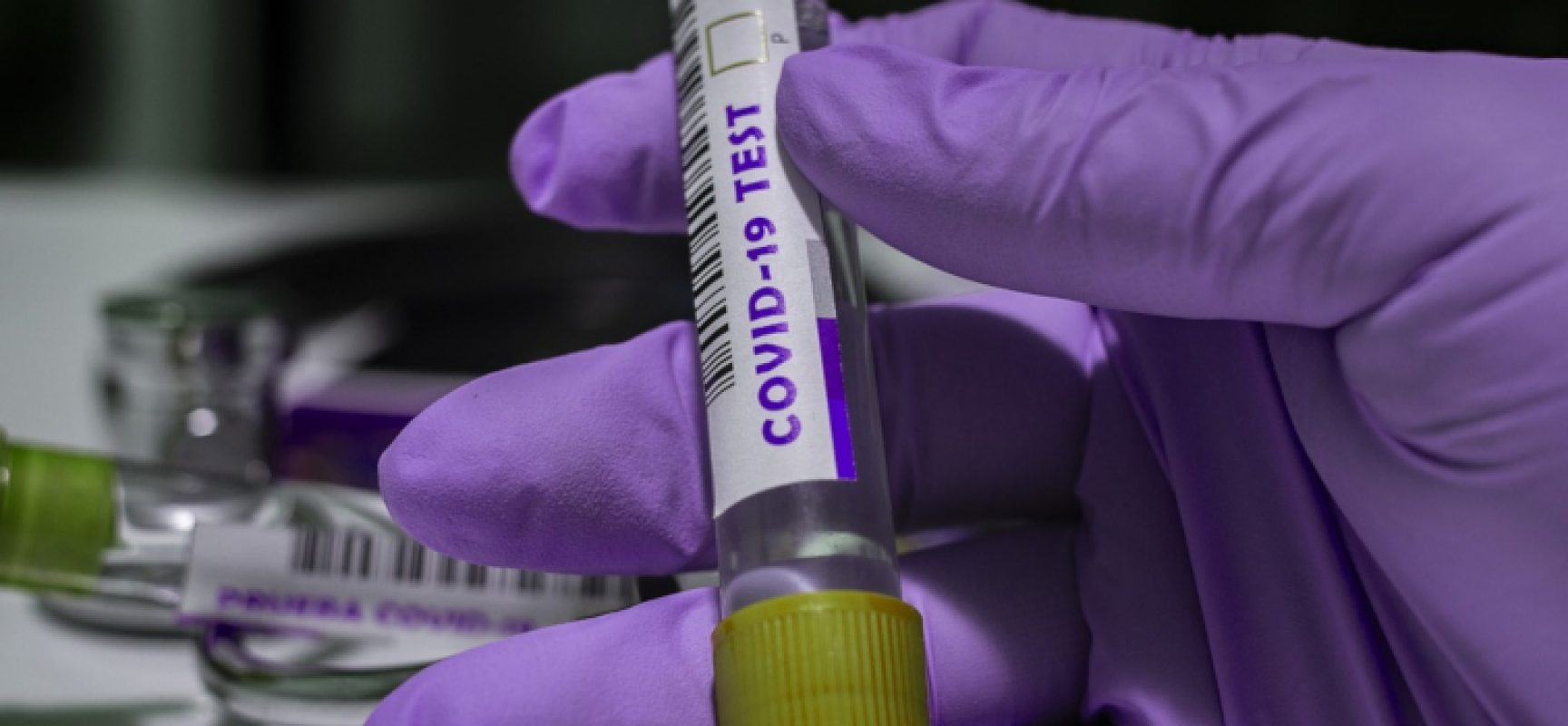 Coronavirus, numeri stabili in Puglia: calano ricoverati in terapia intensiva
